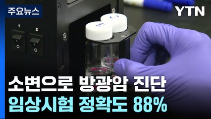 집에서 간편하게 소변으로 방광암 진단...초기 암까지 가능 / YTN