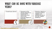 What can be done with varicose veins?