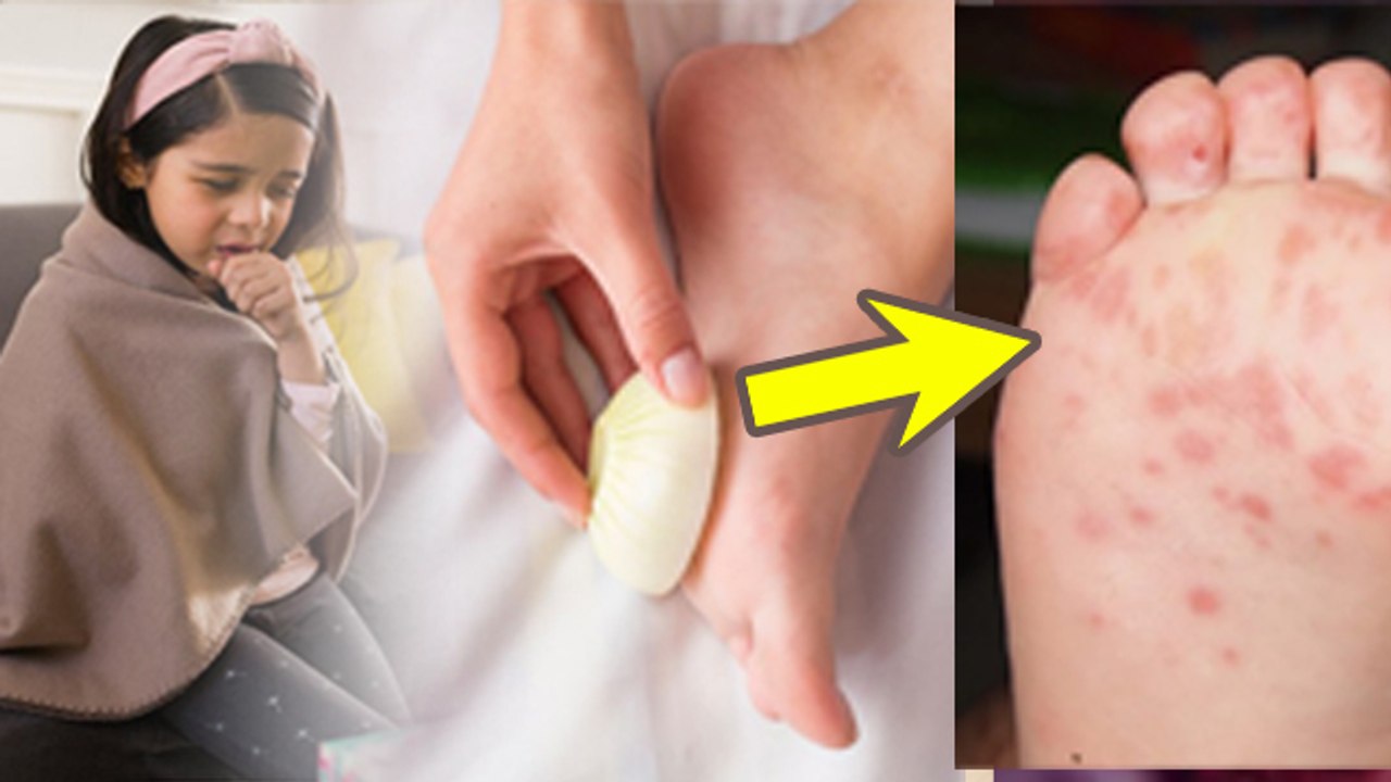 Garlic In Socks For Baby Cold: बच्चे को सर्दी खांसी में मोजे में लहसुन रखना चाहिए या नहीं,