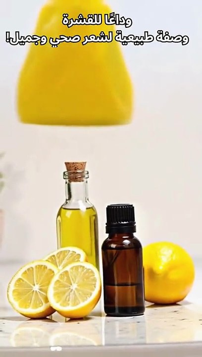 تخلص من قشرة الشعر بخطوات بسيطة! 🌿✨ جرب هذه الوصفة الطبيعية الآن!