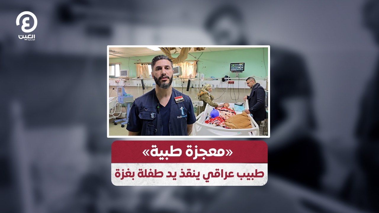 «معجزة طبية»  طبيب عراقي ينقذ يد طفلة بغزة