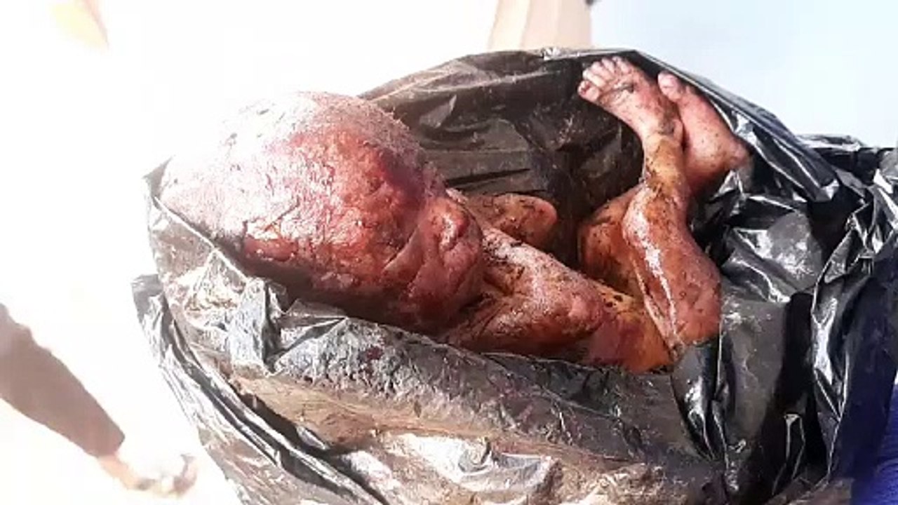 Born baby
