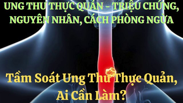 UNG THTHỰC QUẢN - TRIỆU CHỨNG, NGUYÊN NHÂN, CÁCH PHÒNG NGỪA ,Soát Ung Thư Thực Quản, Ai Cần Làm?