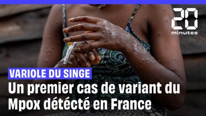 Mpox : Le tout premier cas du nouveau variant identifié en France à Rennes