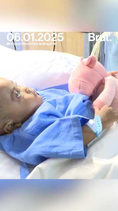 Dominique Ouattara rend visite aux sœurs siamoises séparées.