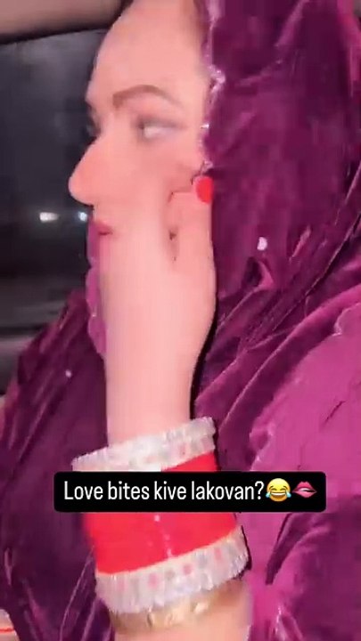 Love bite 💋