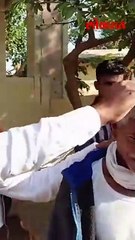 ५ दिवसांत टक्कल..महाराष्ट्रात आलेला हा नवा आजार काय