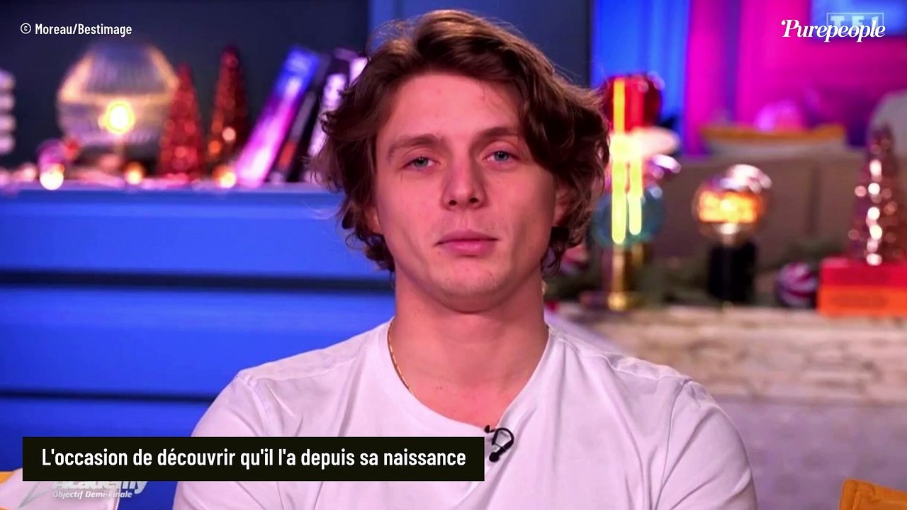 EXCLU Ulysse (Star Academy 2024) se confie sur une particularité physique qu'il a depuis sa naissance
