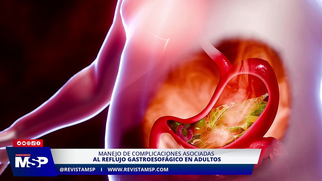 Manejo de complicaciones asociadas al reflujo gastroesofágico en adultos