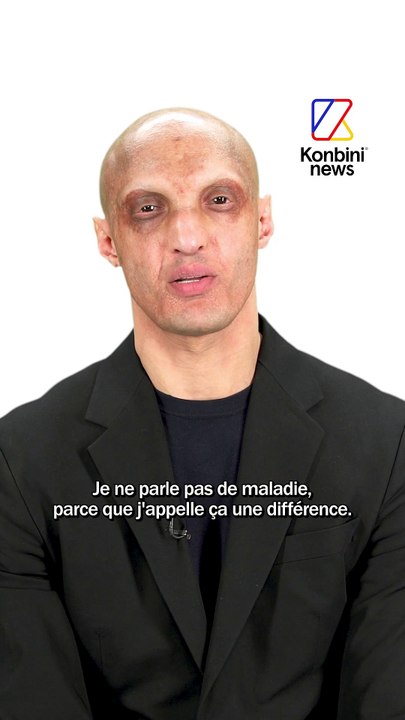 Abdé Maziane raconte l'histoire derrière sa différence