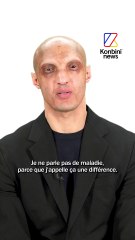 Abdé Maziane raconte l'histoire derrière sa différence