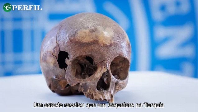 Descobertas surpreendentes: Moedas do imperador romano, crânio equivocado e o futuro pós-humanos