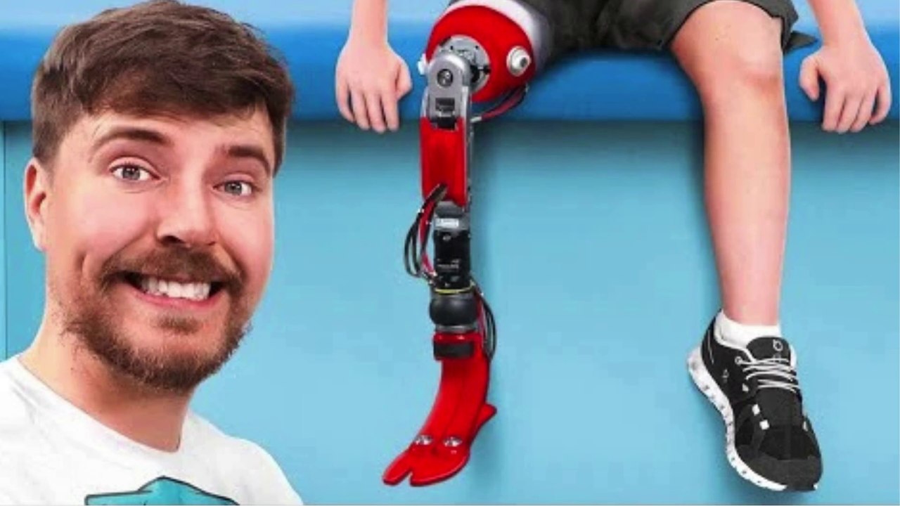 MrBeast Helped 2,000 People Walk Again
