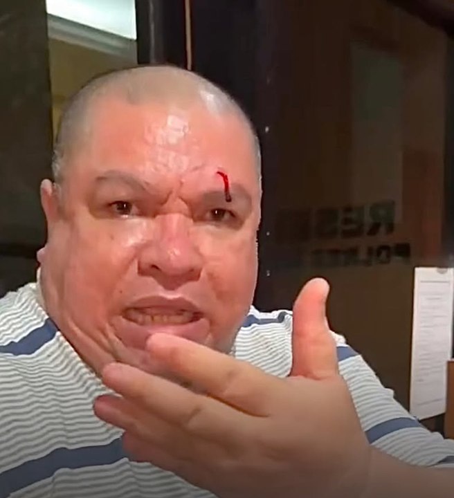 Sebut Dipukul Nikita Mirzani, Razman Nasution Tunjukkan Wajah Berdarah