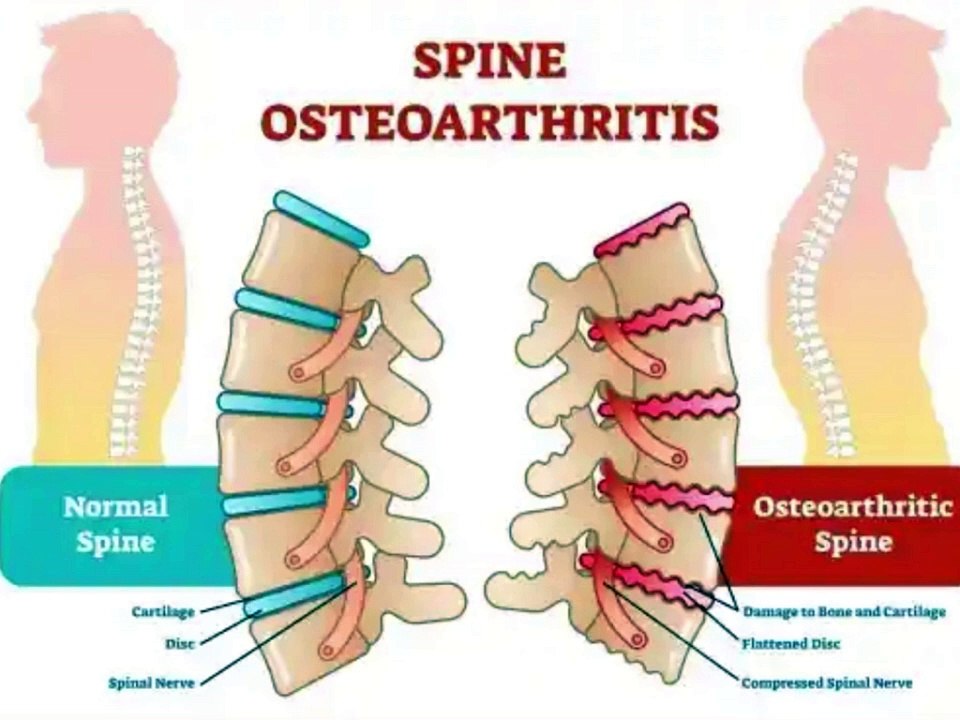 Bone and joint pain all over the body | Causes of pain in bones and muscles of the whole body,