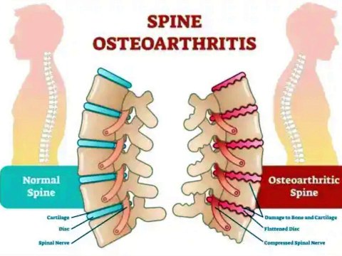 Bone and joint pain all over the body | Causes of pain in bones and muscles of the whole body,