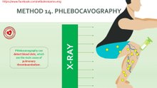 What is phlebocavography?