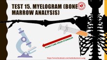 What is myelogram (bone marrow analysis)?