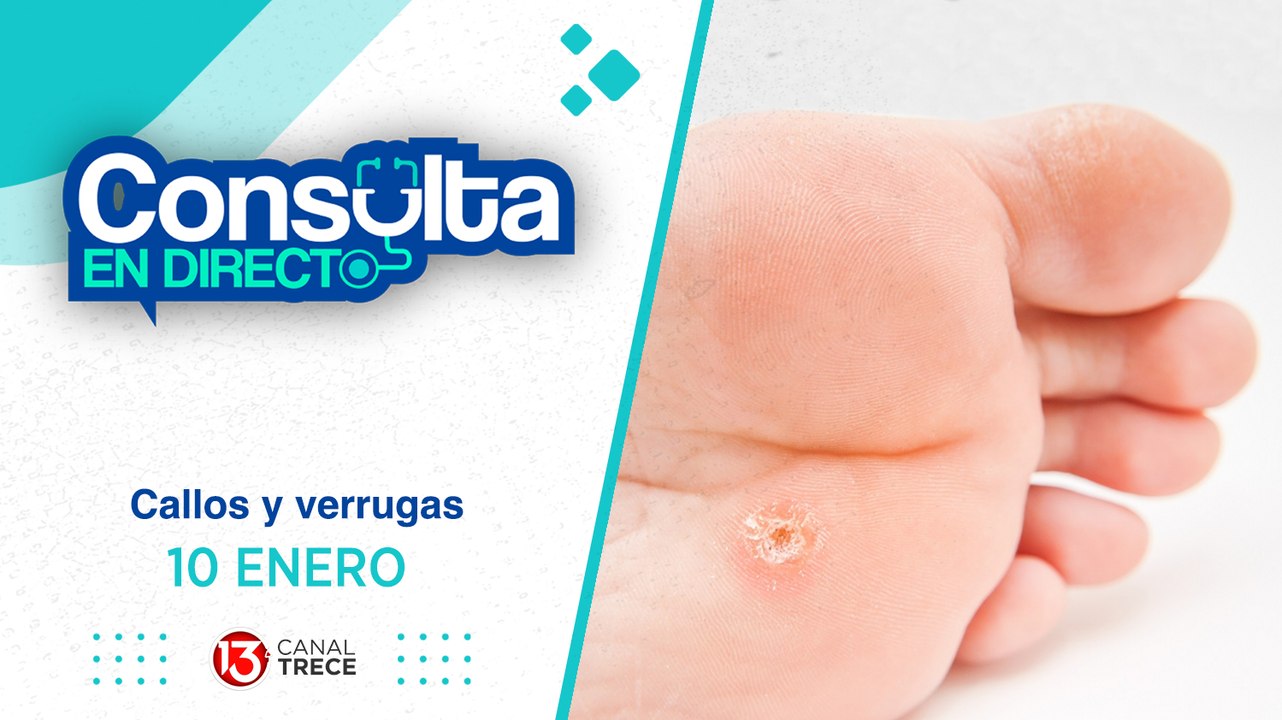 10 Enero 2025 | Consulta en Directo - Callos y verrugas