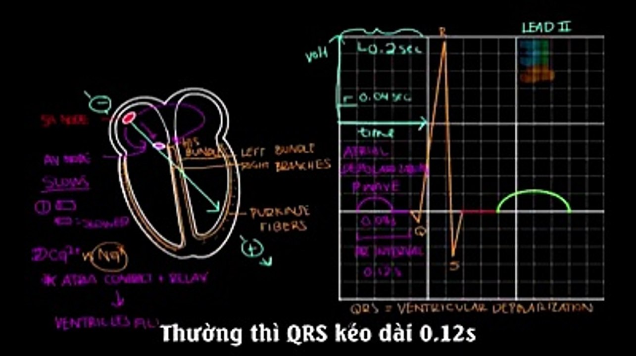Bài giảng hướng dẫn đọc điện tim đồ
