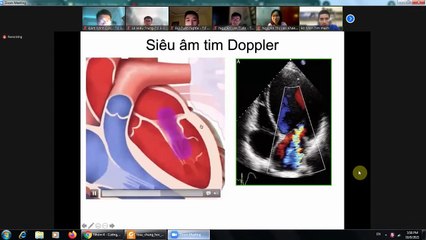 Lâm sàng nội y4 - Cơ bản về siêu âm tim