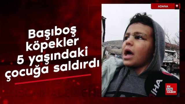 Adana'da başıboş köpekler 5 yaşındaki çocuğa saldırdı