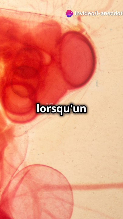 Les triplets siamois : Un phénomène rarissime