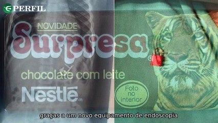 "Surpresa em São Paulo: Criança engole cadeado, relançamento de chocolate e celebração francesa no Museu da Imigração"