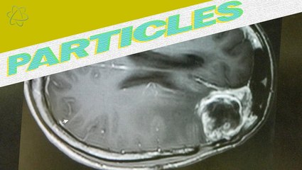 Zika:  Could This Be Used As A Cancer Treatment? - thumbnail