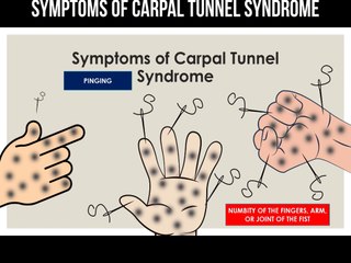 Signs of carpal tunnel syndrome