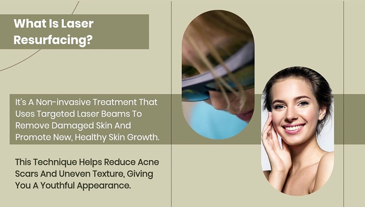 Laser Resurfacing