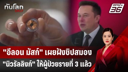 "อีลอน มัสก์" เผยฝังชิปสมอง "นิวรัลลิงก์" ให้ผู้ป่วยรายที่ 3 แล้ว | ทันโลก DAILY | 17 ม.ค. 68