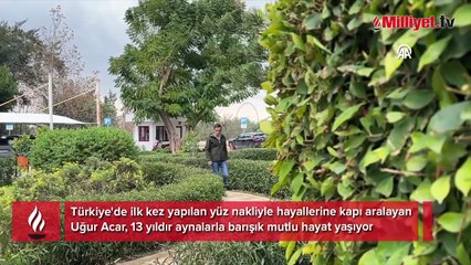 Türkiye'de bir ilk oldu! Önce yüzü, sonra hayatı değişti: Çocukken toplumun içine çıkmaya çekiniyordum