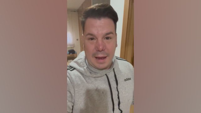 Lucas, de ‘Andy y Lucas’, obligado a pedir perdón por mentir sobre su nariz: “No quería dar muchas explicaciones”