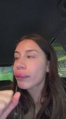 El importante consejo de una influencer después de que una operación estética le saliera mal