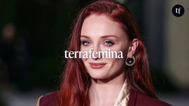 Elle est squelettique là : cette actrice de Game of Thrones beaucoup trop maigre selon les internautes