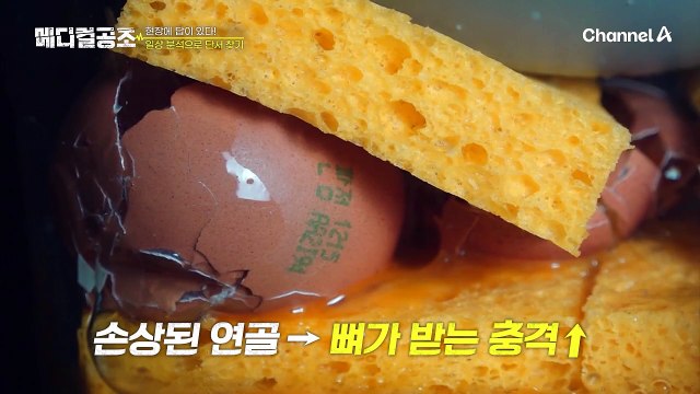 ※퇴행성 관절염 10년 차 문영미※ 무릎 건강을 망치는 그녀의 일상 속 습관은?