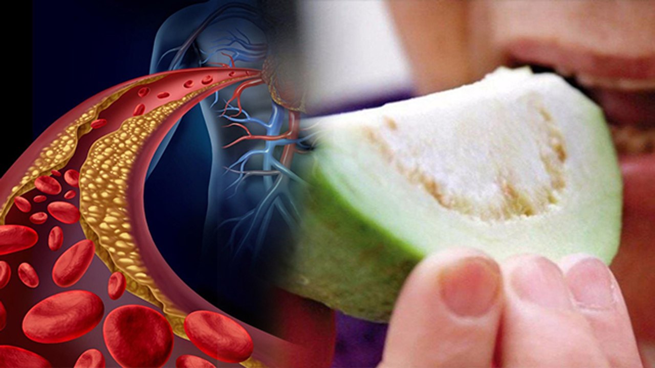 हाई कोलेस्ट्रॉल में अमरूद खाने के फायदे, High Cholesterol Me Amrudh Khane Ke Fayde | Boldsky