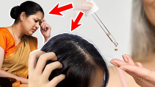 नारियल के तेल के मालिश से क्या होता है,नारियल के तेल के मालिश के फायदे | Coconut Oil Benefits..