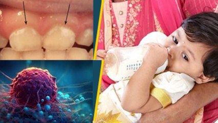 Fact Check: बच्चो को बोतल से दूध पिलाने से कैंसर, कैविटी जैसी बीमारियां होती है क्या | Boldsky