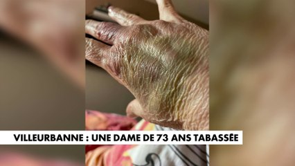 Villeurbanne : une dame de 73 ans tabassée