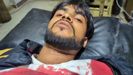 क्रिकेट खेल रहे छात्र को बदमाशों ने मारी गोली