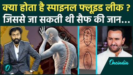 Saif Ali Khan Attacked: क्या वाकई Spinal Fluid Leak से जान सकती थी सैफ की जान | वनइंडिया हिंदी