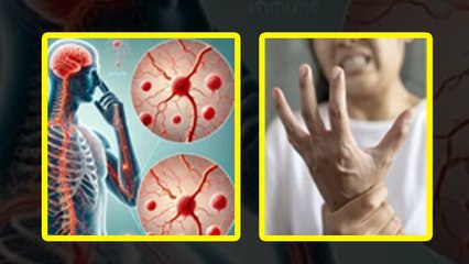 Guillain Barr Syndrome in Pune: गुइलेन में फैली बैरी सिंड्रोम, लक्षण और बचाव | Boldsky