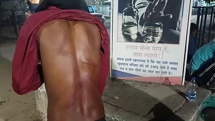 प्लांट के भीतर नाबालिगो की बेदम पिटाई, अज्ञात सुरक्षाकर्मियों पर एफआईआर दर्ज