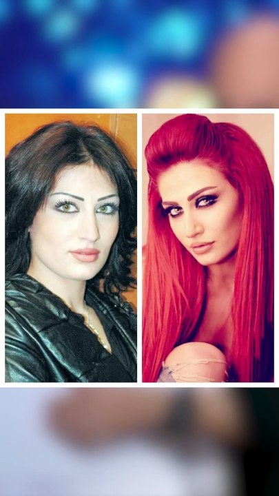 هبة نور قبل وبعد التجميل