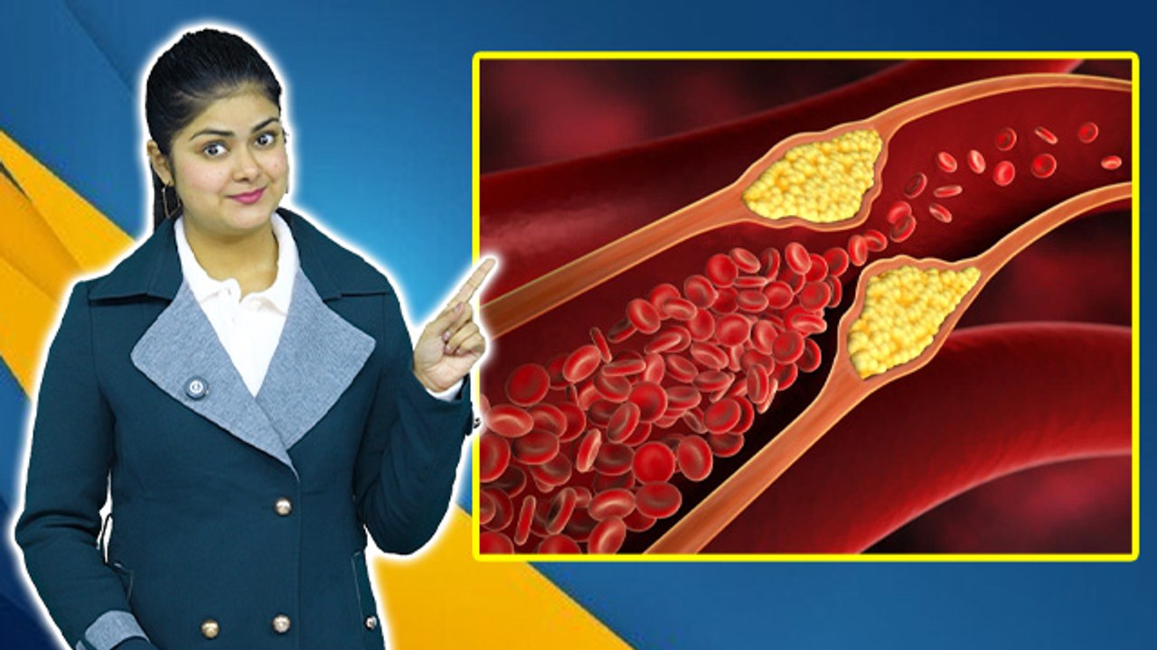 High Cholesterol Me Kya Khana Chahiye Kya Nahi, Diet Plan & Foods To Avoid...