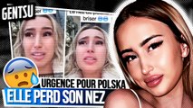 Polska est sur le point de perdre son nez ? 😱