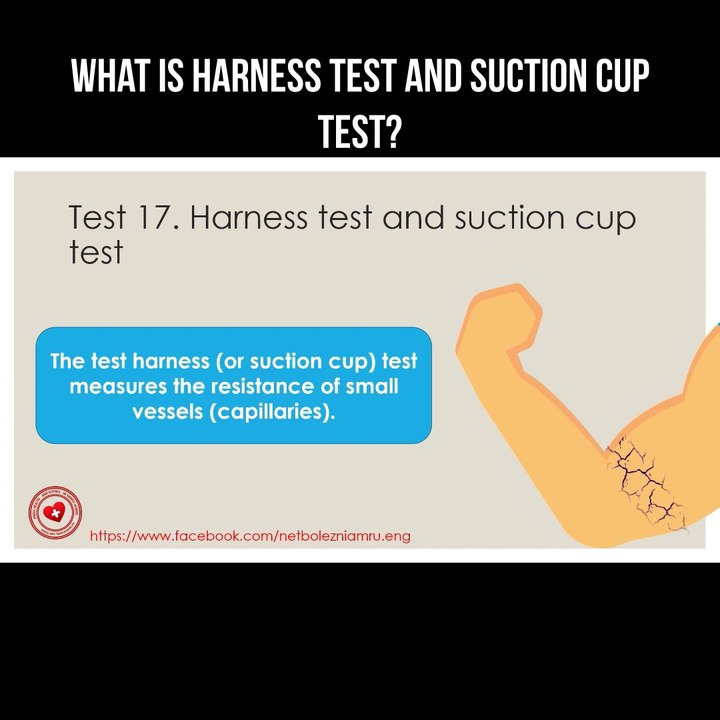 What is harness test and suction cup test?