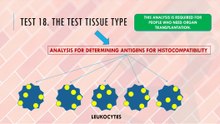 What is test of tissue type?